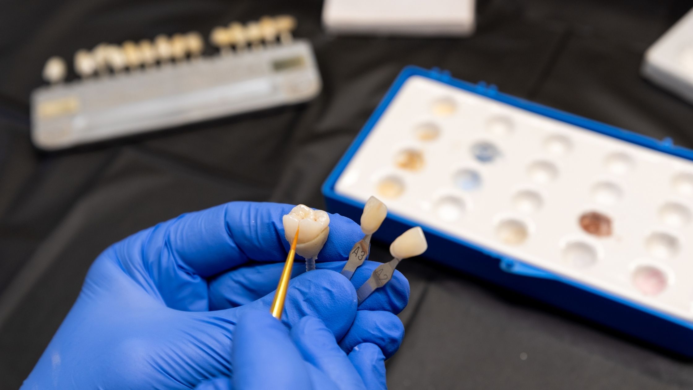 Dental Implants Vs. Crowns: Which Is Best For Me?