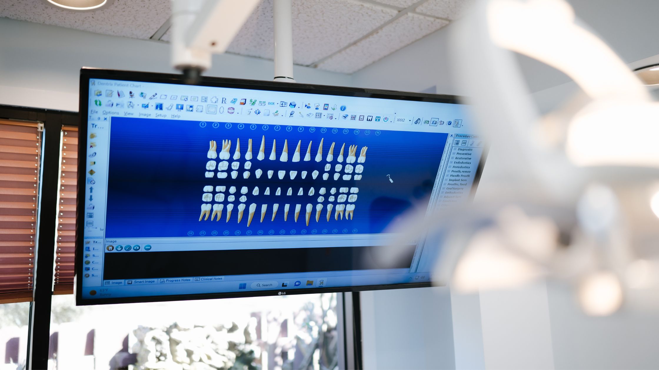 4 Factors Seniors Should Consider When Choosing Dental Implants or Dentures